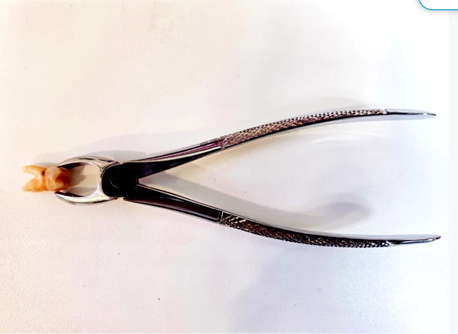 Chirurgia estrattiva2